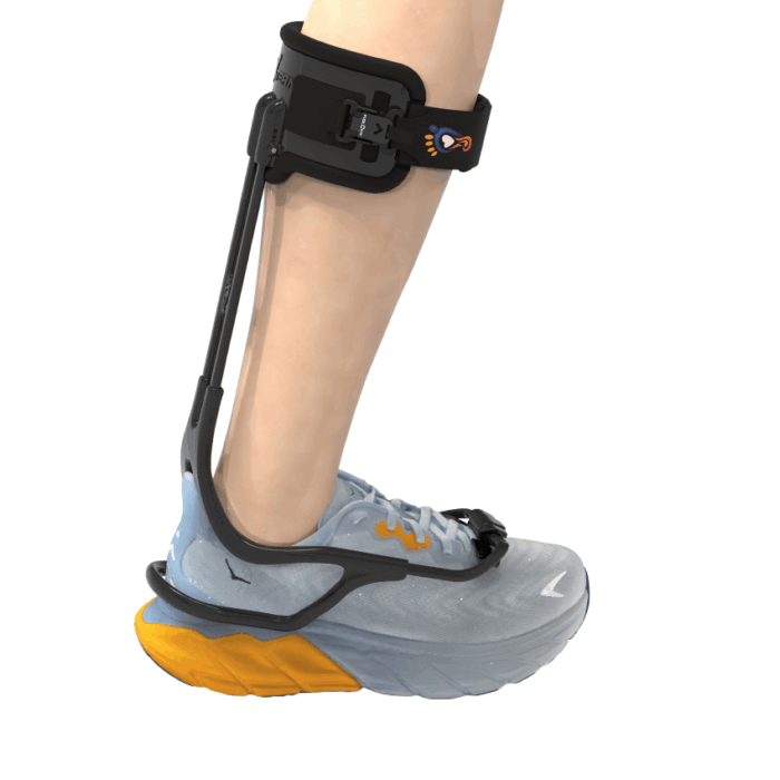 Xtern Magnet Buckle Strap - Image 3
