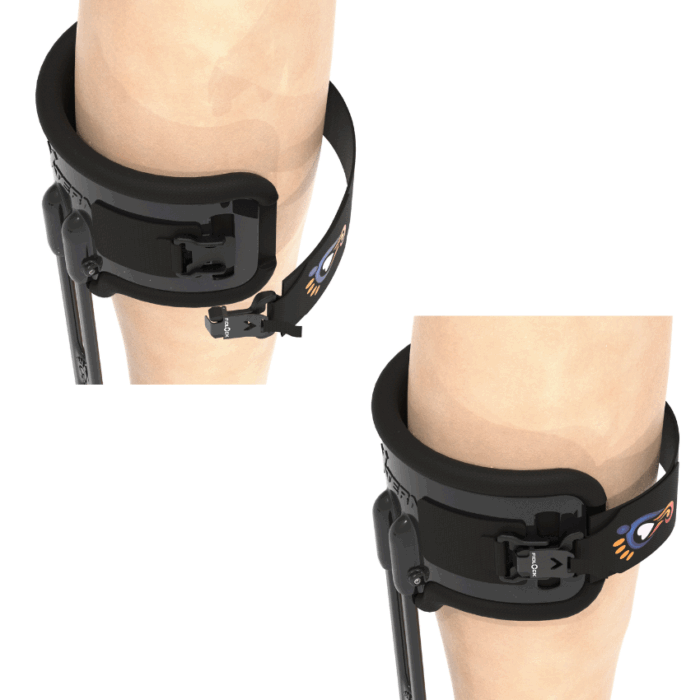 Xtern Magnet Buckle Strap - Image 4