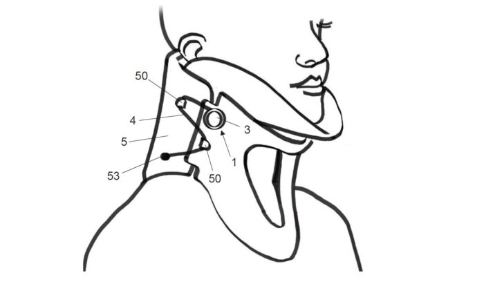 FidLock Winch - Bild 6